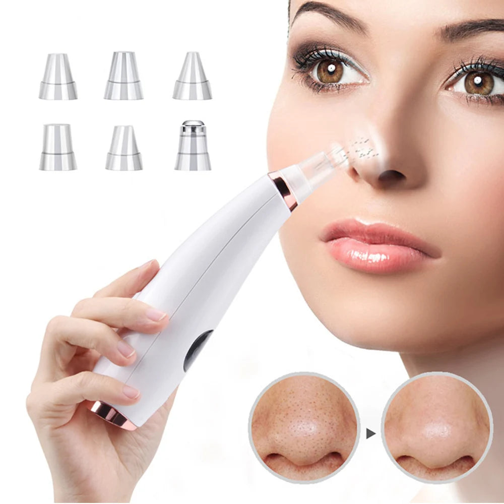 Electric Blackhead and Acne Remover – Black Spot Elimination, Deep Pore Cleansing, Skin Care Machine.