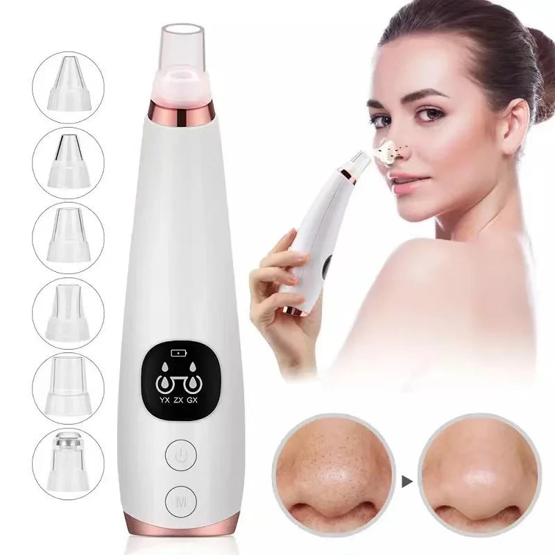 Electric Blackhead and Acne Remover – Black Spot Elimination, Deep Pore Cleansing, Skin Care Machine.